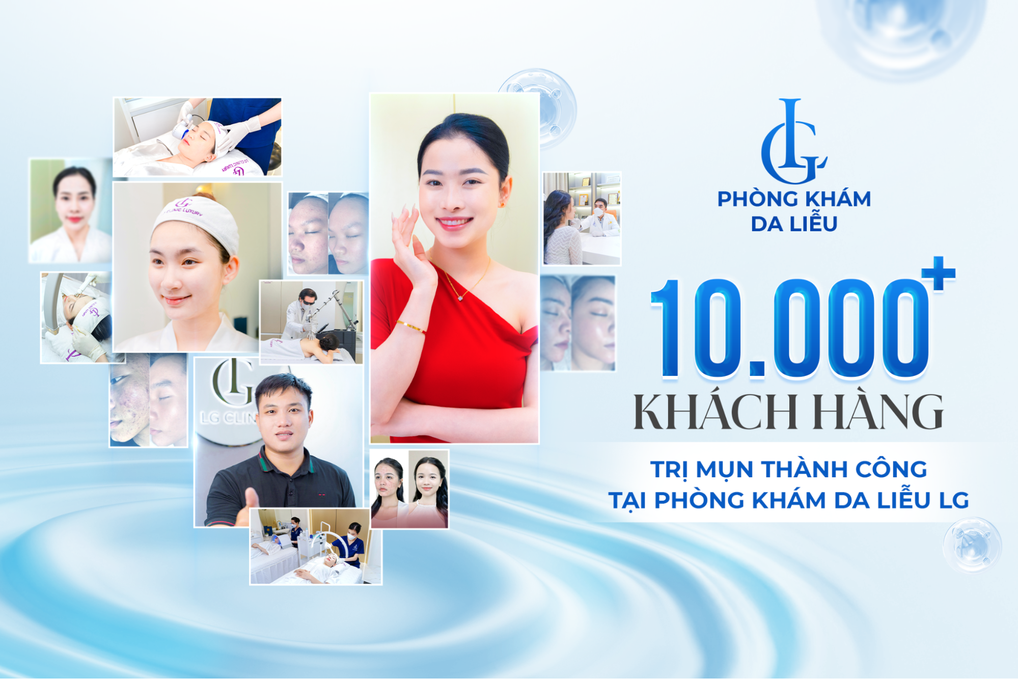 Hàng ngàn khách hàng thành công dứt điểm các vấn đề da liễu, tìm lại làn da khỏe mạnh tại Phòng khám Da liễu LG