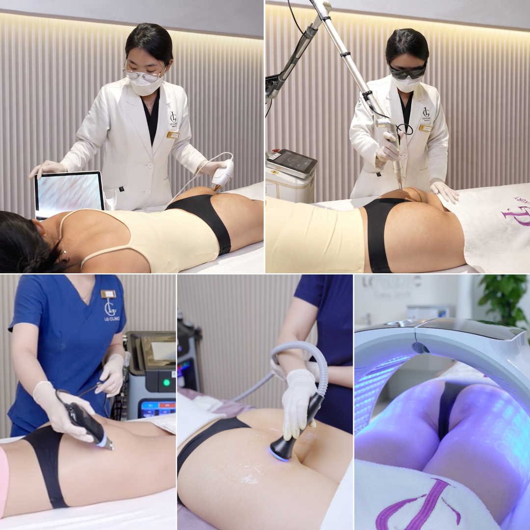 địa chỉ trị thâm body uy tín
